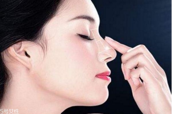 隆鼻需要修复吗,隆鼻后效果不满意可以免费修复吗