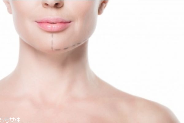 垫下巴有哪些材料,垫下巴的材料