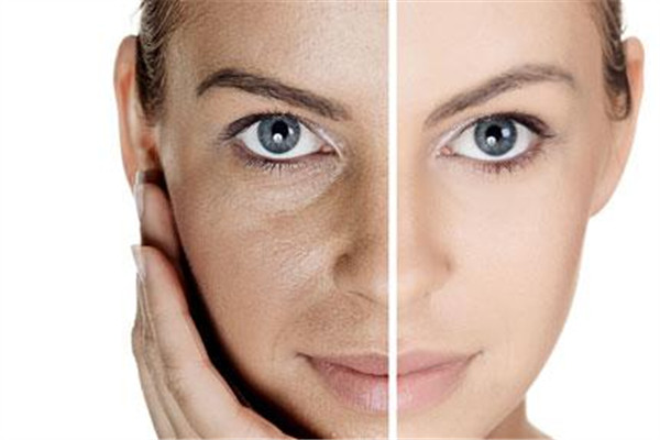 自体脂肪填充额头有风险吗,自体脂肪填充额头存活率高吗