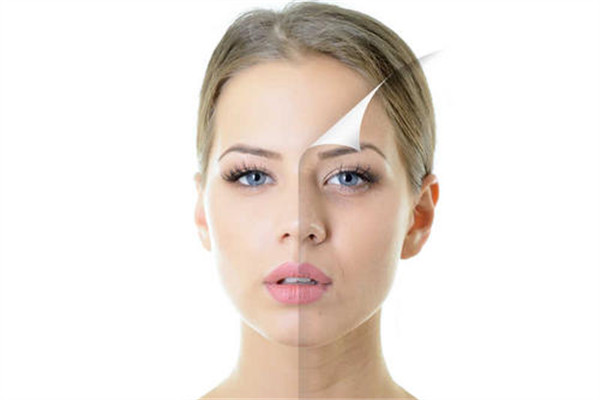 自体脂肪填充是永久性的吗,自体脂肪填充安全吗?