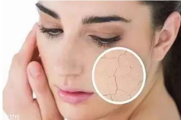 用什么方法除皱效果最好,目前除皱最好的方法是什么