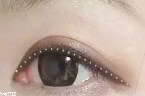 美瞳线几天恢复好,做美瞳线几天可以恢复