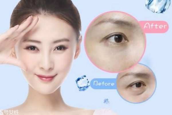 外切眼袋刀口什么时候才能恢复,外切眼袋疤痕多久消失