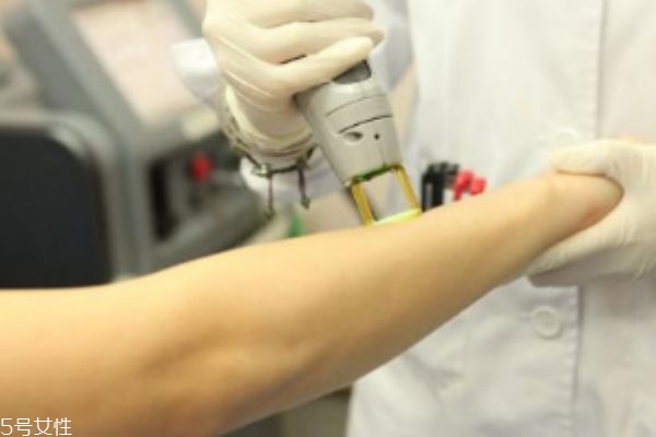 激光脱毛后多久可以碰水,激光脱毛后碰水了会不会没效果 激光脱毛后多久可以碰水,激光脱毛后碰水了会不会没效果