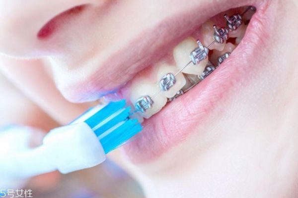 20岁还可以整牙齿吗,20岁还可以整牙吗