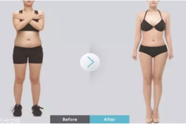 大腿吸脂手术多久可以不疼了,小腿吸脂疼还是大腿吸脂疼 大腿吸脂手术多久可以不疼了,小腿吸脂疼还是大腿吸脂疼