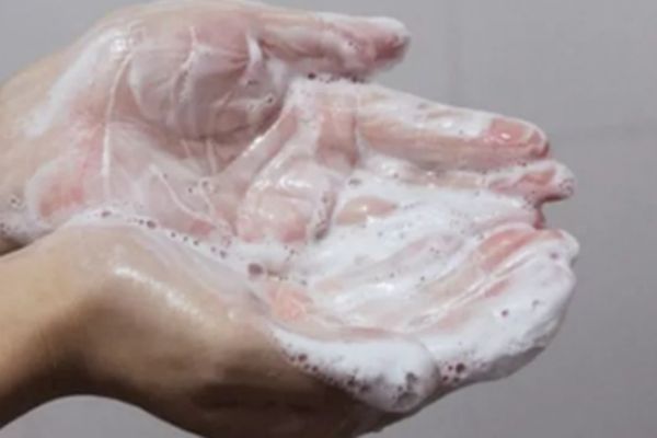 割了双眼皮多久可以正常洗脸,双眼皮切割手术后多久可以洗脸