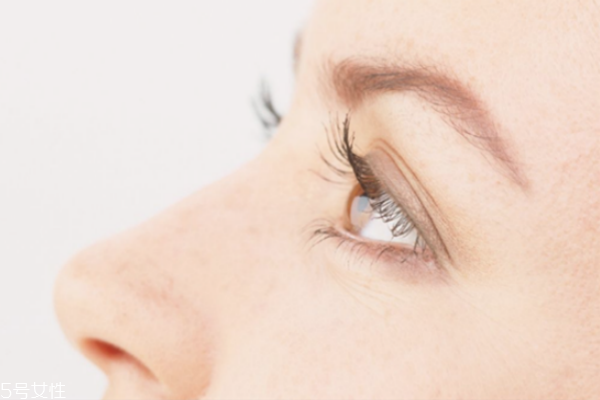 鱼尾纹除皱针怎么没什么效果,鱼尾纹除皱针有什么副作用