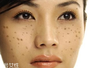 皮秒对皮肤有伤害吗,皮秒有副作用吗