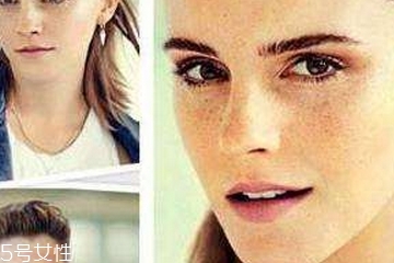 皮秒能去老年斑吗,激光能去老年斑吗