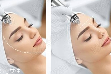 小气泡溶液怎么使用方法,小气泡溶液怎么使用