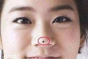 点痣能不能带口罩,点完痣可以戴口罩出门吗 点痣能不能带口罩,点完痣可以戴口罩出门吗