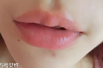 嘟嘟唇是天生的吗,天生嘟嘟唇是什么样子的