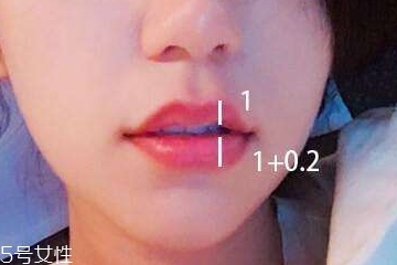 地包天打嘟嘟唇好看吗,做嘟嘟唇图片