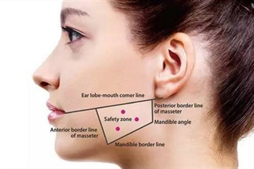 什么脸适合打瘦脸针,什么人适合瘦脸针