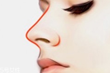 垫鼻尖大概要多少钱,把鼻子垫高要多少钱