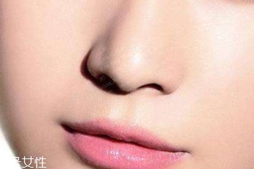 鼻唇沟填充用什么最好,鼻唇沟填充前后图片