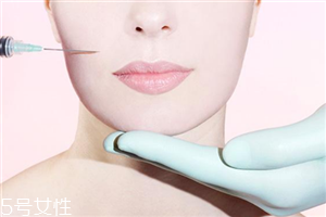 法令纹填充后脸更臃肿,填充法令纹后脸型变了