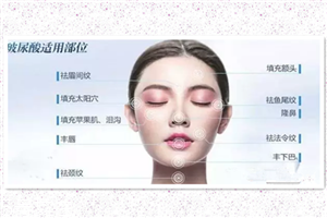 国产玻尿酸好吗,国产玻尿酸好吗能管多久