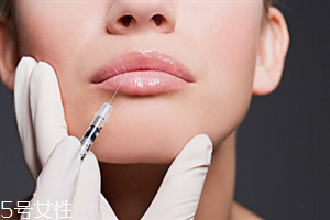 玻尿酸丰唇能维持多久,嘴巴打玻尿酸可以维持多久