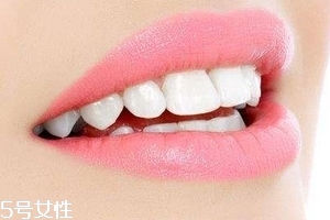 超声波洁牙牙齿会变白吗?,超声波洗牙牙齿会变白吗