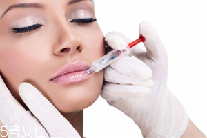 玻尿酸丰唇后如何快速消肿,玻尿酸丰唇后肿胀怎么办