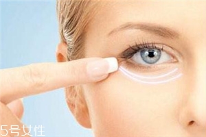 1.5的嗨体可以填充泪沟吗,嗨体可以填充泪沟吗?