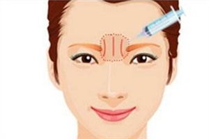 川字纹可以手术去除吗,川字纹能手术吗 川字纹可以手术去除吗,川字纹能手术吗