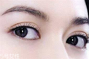 割双眼皮怎么快速消肿,做完双眼皮眼睛肿了怎么快速消肿 割双眼皮怎么快速消肿,做完双眼皮眼睛肿了怎么快速消肿