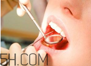 洗牙对牙齿好吗?有损害吗,洗牙对牙齿有伤害吗?