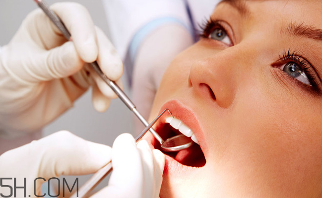 哪种情况不能洗牙,什么情况下不可以洗牙 哪种情况不能洗牙,什么情况下不可以洗牙