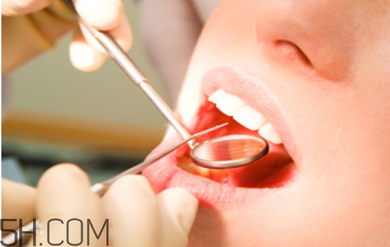 洗牙的时候出血正常吗,洗牙牙出血正常吗