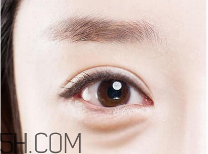 超声波去眼袋效果好吗,超声法去眼袋是怎么做的呢?