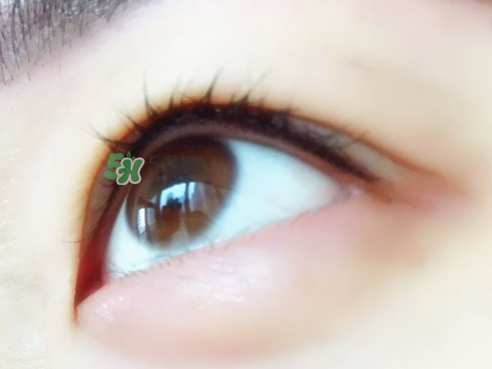 做美瞳线麻药灼伤眼睛怎么处理,美瞳线麻药进眼严重吗