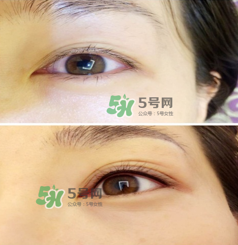 做美瞳线眼睛会不会肿,美瞳线做完眼睛肿有什么办法不肿