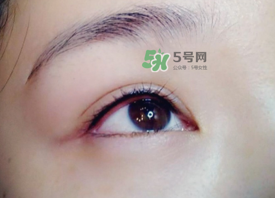 做美瞳线会疼吗,做美瞳线以后要注意什么