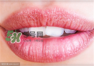 洗牙之后抛光,洗完牙要不要抛光