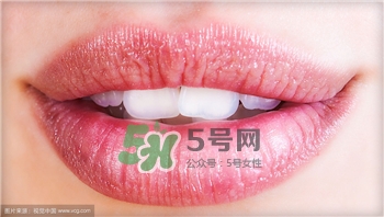 洗牙之后多久可以吃东西吗,洗完牙多久可以吃东西