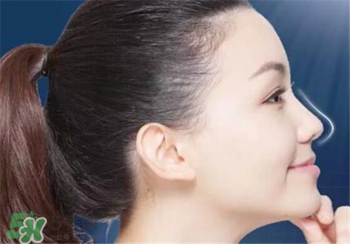 隆鼻会让眼距变近吗,隆鼻后眼距会变近吗