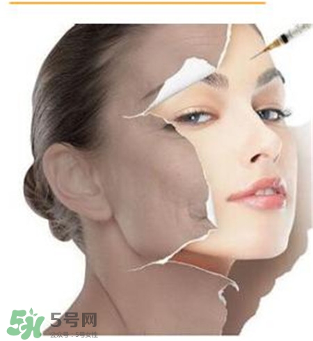 注射美白针能全身美白吗,打美白针真的有效吗 注射美白针能全身美白吗,打美白针真的有效吗