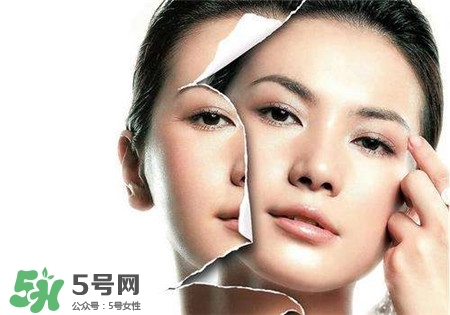 美白针能打吗?,美白针打一次有效果吗 美白针能打吗?,美白针打一次有效果吗