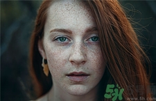 激光祛斑几天结痂完全可以脱落,激光祛斑后结的痂几天掉