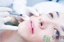 玻尿酸有什么功效和副作用,玻尿酸有啥副作用 玻尿酸有什么功效和副作用,玻尿酸有啥副作用