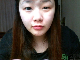 肿眼泡怎么消除,肿眼泡吸脂一般价位