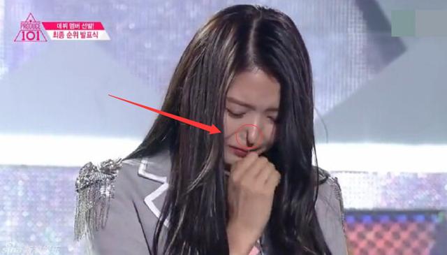 任娜英鼻子一捏之后居然塌了,任娜英鼻子怎么回事 任娜英鼻子一捏之后居然塌了,任娜英鼻子怎么回事