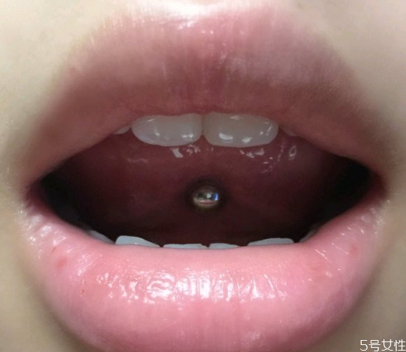 舌钉多久不戴会长死,舌钉带了4年了能长死吗