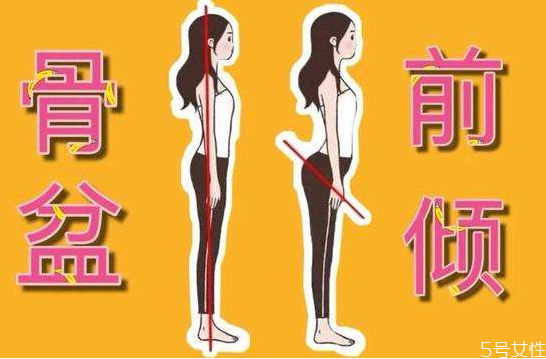 导致骨盆前倾的原因,怎么治骨盆前倾 导致骨盆前倾的原因,怎么治骨盆前倾