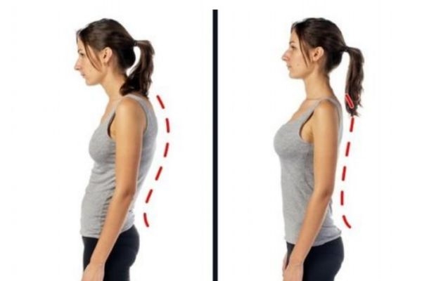 造成圆肩驼背的原因有哪些?,圆肩是驼背吗