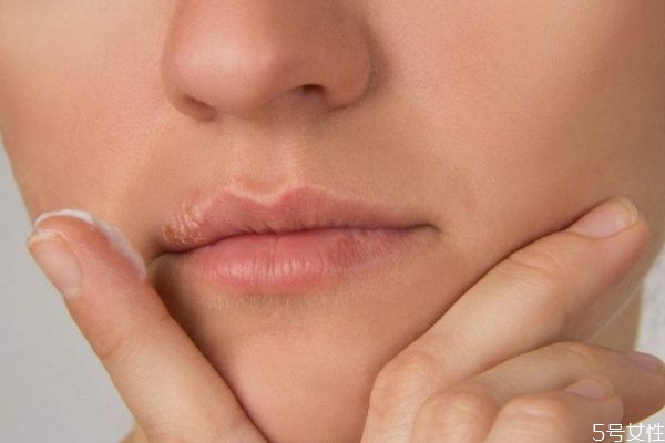 女性有唇毛什么原因,唇毛是什么原因导致的