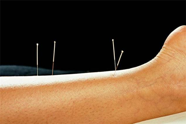 针灸能喝酒抽烟吗,针灸能戒烟吗